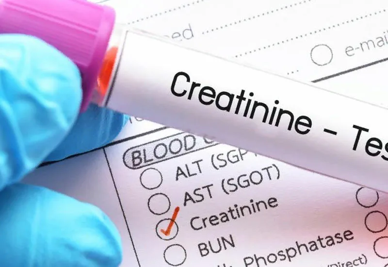 Kreatinin (Cr) und Kreatinin‑Clearance bei Gicht